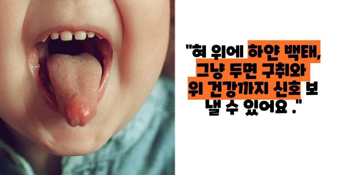 백태 없애는 방법