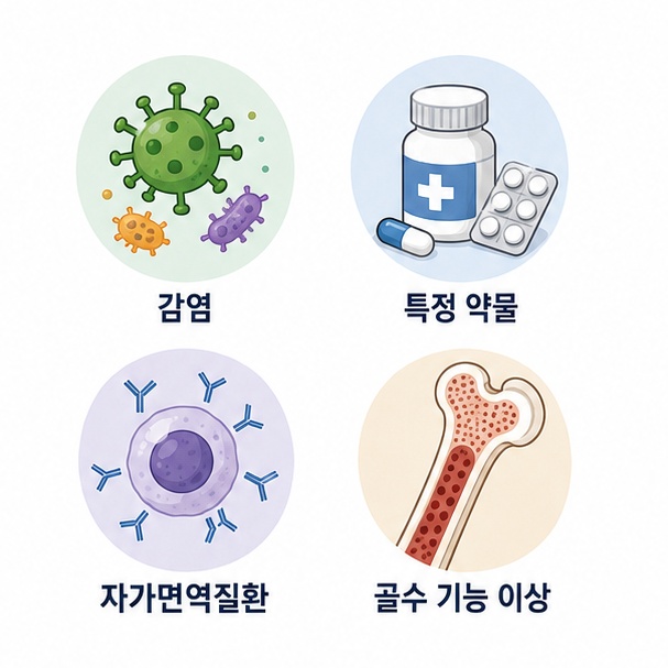 감염과 특정 약물, 자가면역질환, 골수 기능 이상 등 백혈구가 낮아질 수 있는 여러 원인을 보여주는 그림