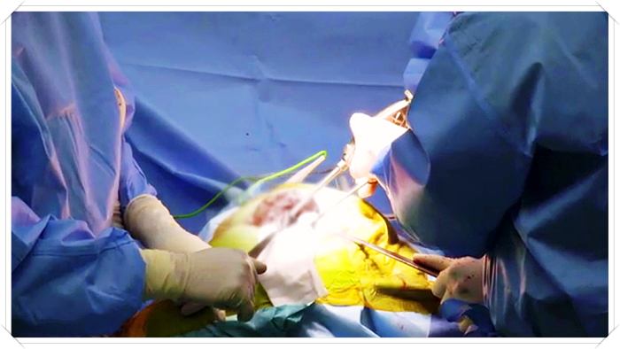 명의-고관절-명의-이우석-교수-수술