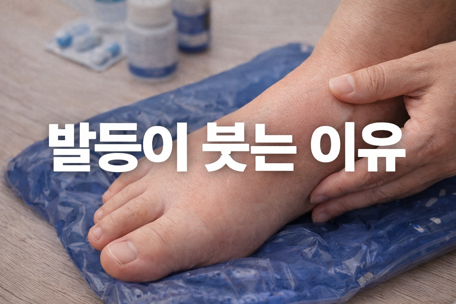 발등이 붓는 이유