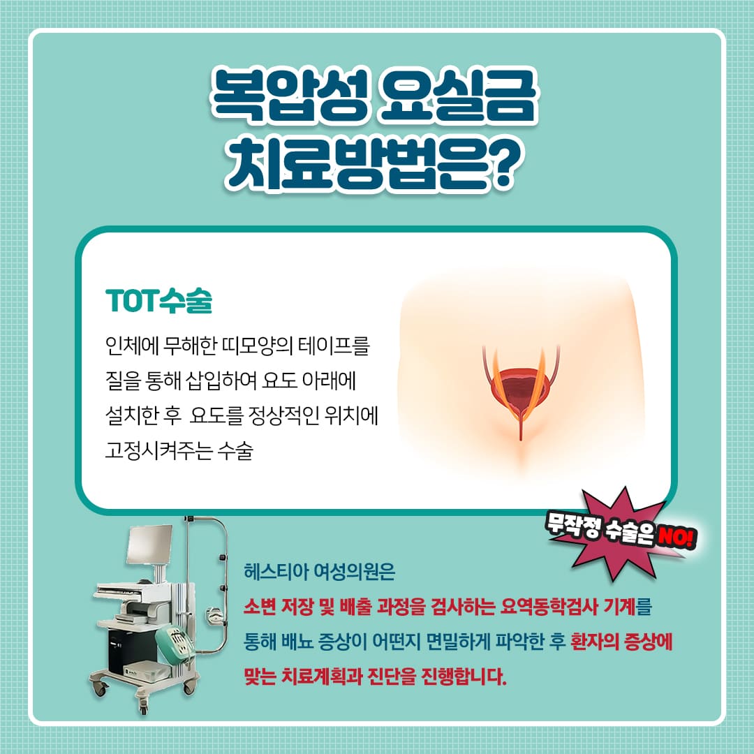복압성 요실금 수술 치료방법은?