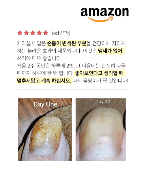 손톱 발톱 무좀 영양제 케라셀 네일 효능&#44; 후기