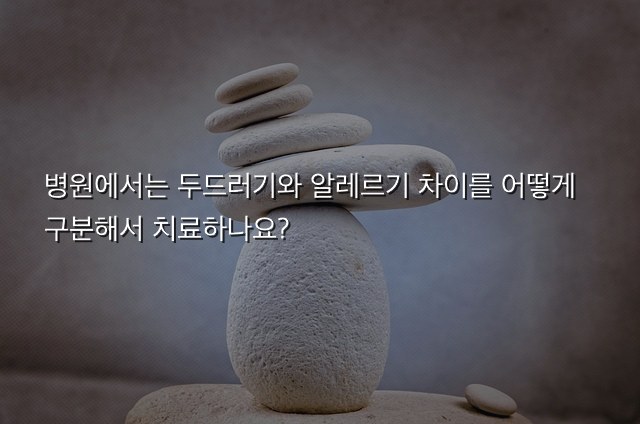 두드러기와 알레르기 차이 병원에서는 두드러기와 알레르기 차이를 어떻게 구분해서 치료하나요?