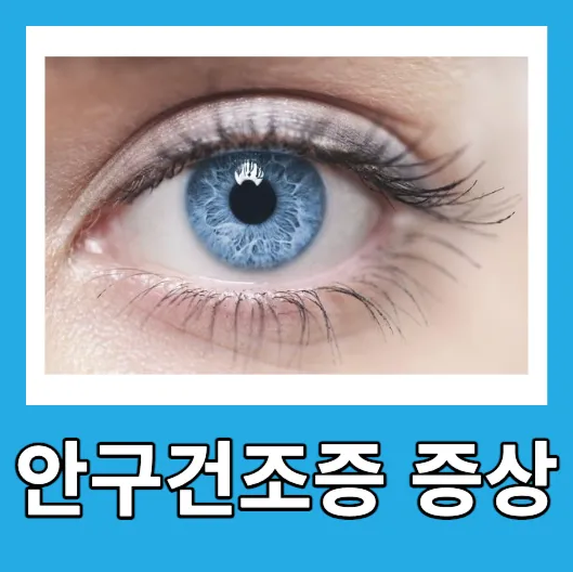 안구건조증 증상