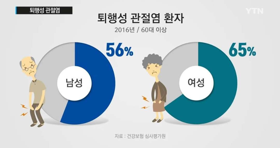 관절염 초기증상