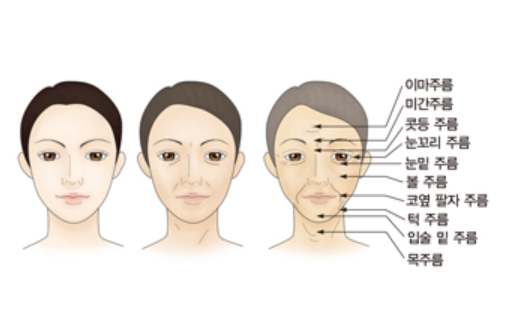 안면거상 수술이란&#44; 효과&#44; 후기&#44; 비용&#44; 주의사항 총정리
