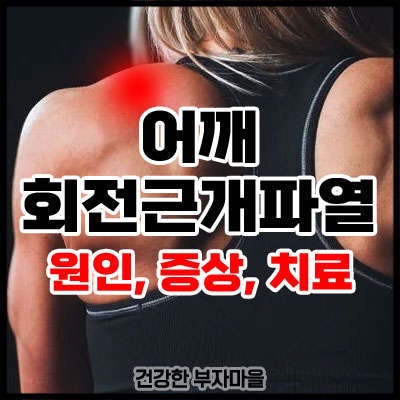 어깨 회전근개파열