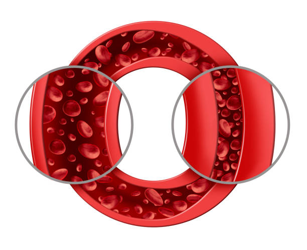 혈압 고혈압 수축기 이완기 차이 높을 때 높으면 낮추는 방법 법 이유 뜻 90 100 단독