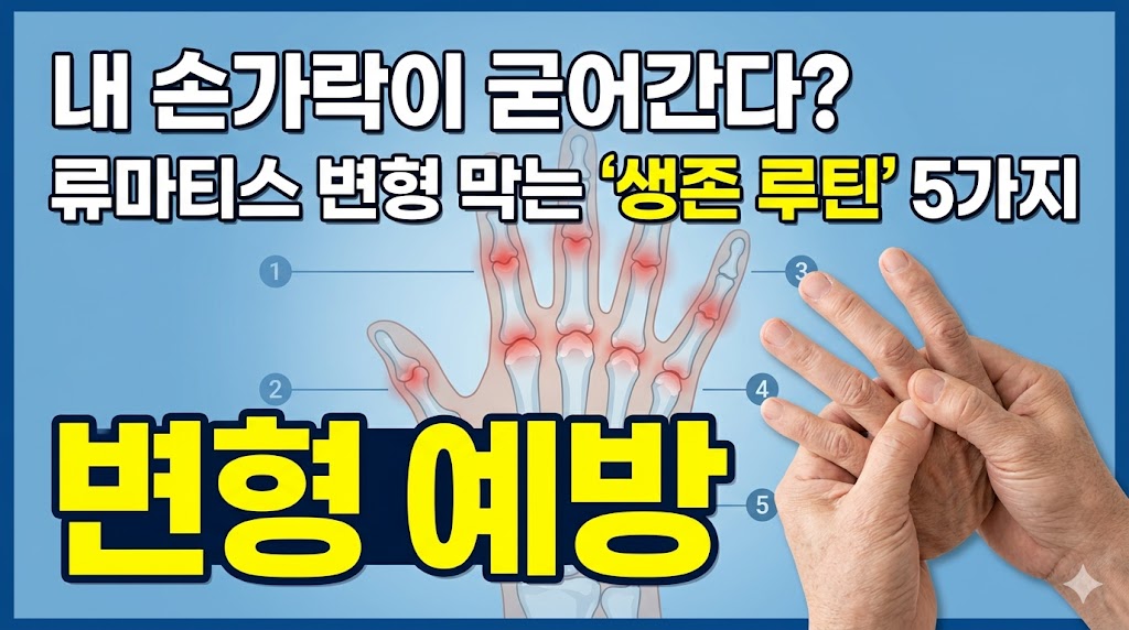 류마티스 관절염 손가락 변형 예방 생활습관 2026 가이드 섬네일