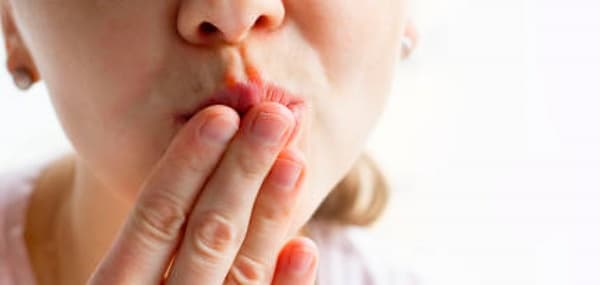 혀색깔로 보는 건강 상태 - 붉음·하얗음·노랗음 의미 정리