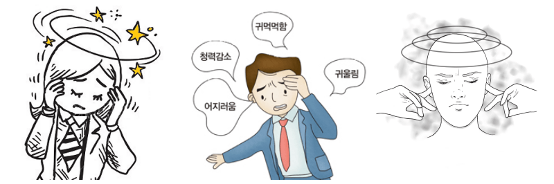 메니에르병 관련 사진 3개