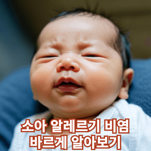 소아 알레르기 비염