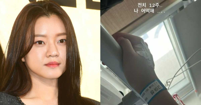 고아성 전치 12주 사진