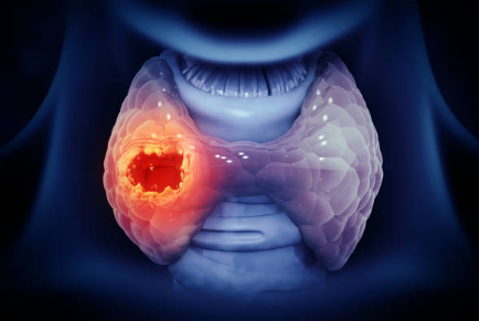 갑상선 기능 항진증 증상, 수치, 검사 총정리 (2024ver)
