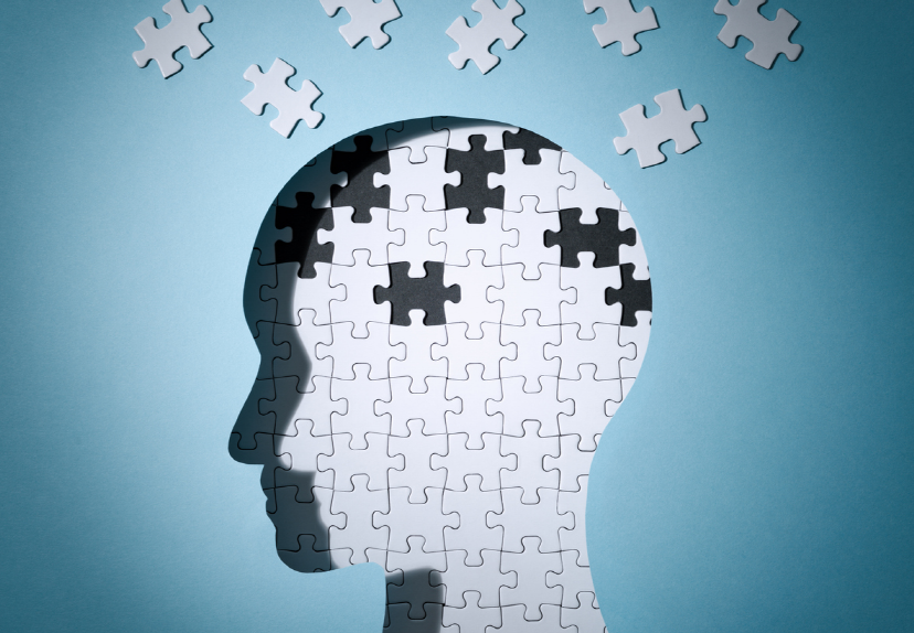 망각을 설명하는 이미지