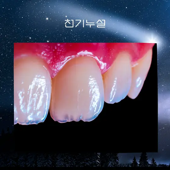 이빨빠지는꿈해몽