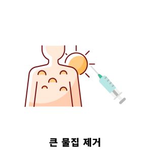 화상 물집 치료방법