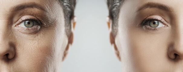 여름철보양식섭취의중요성