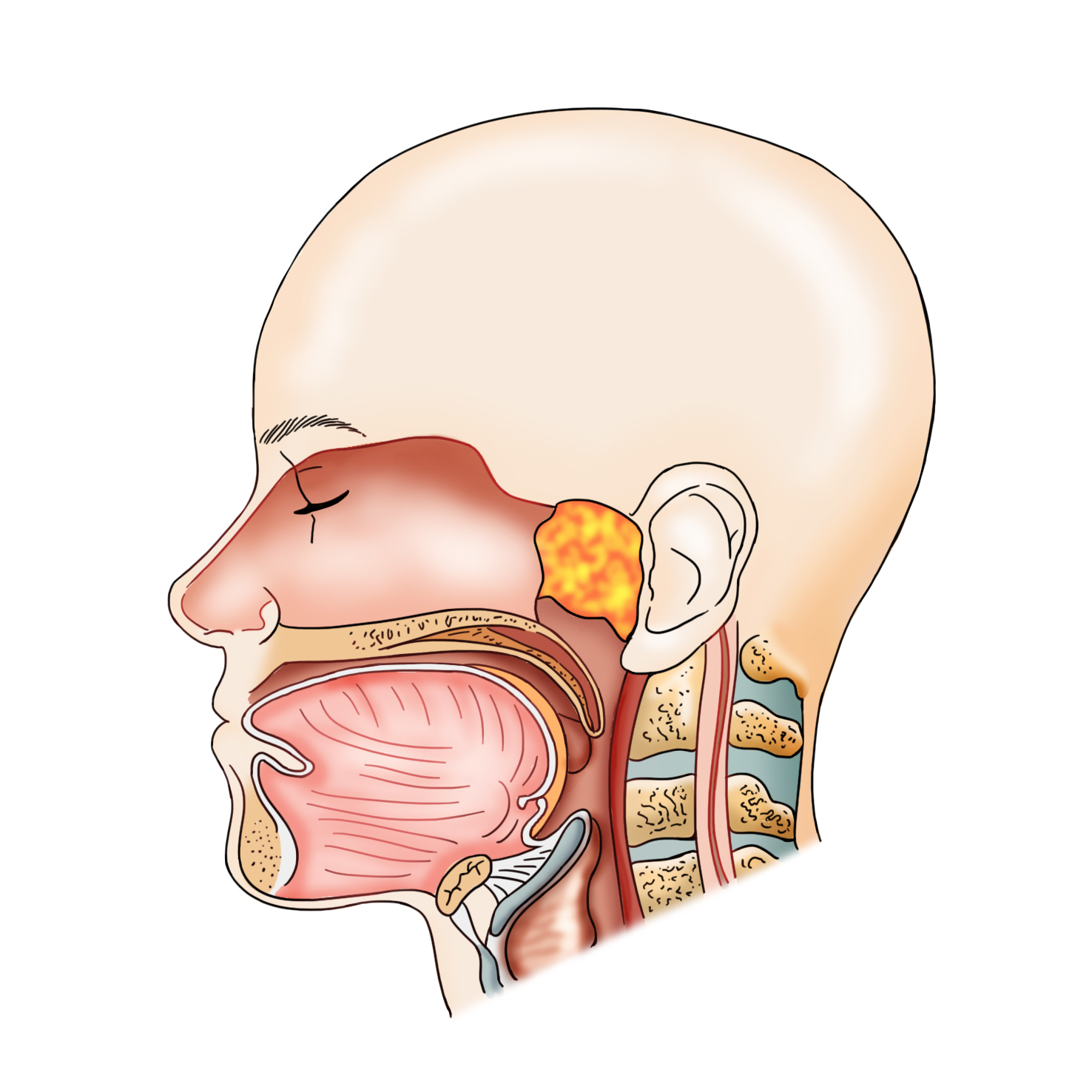 두경부암 출처 서울 아산 병원 홈페이지