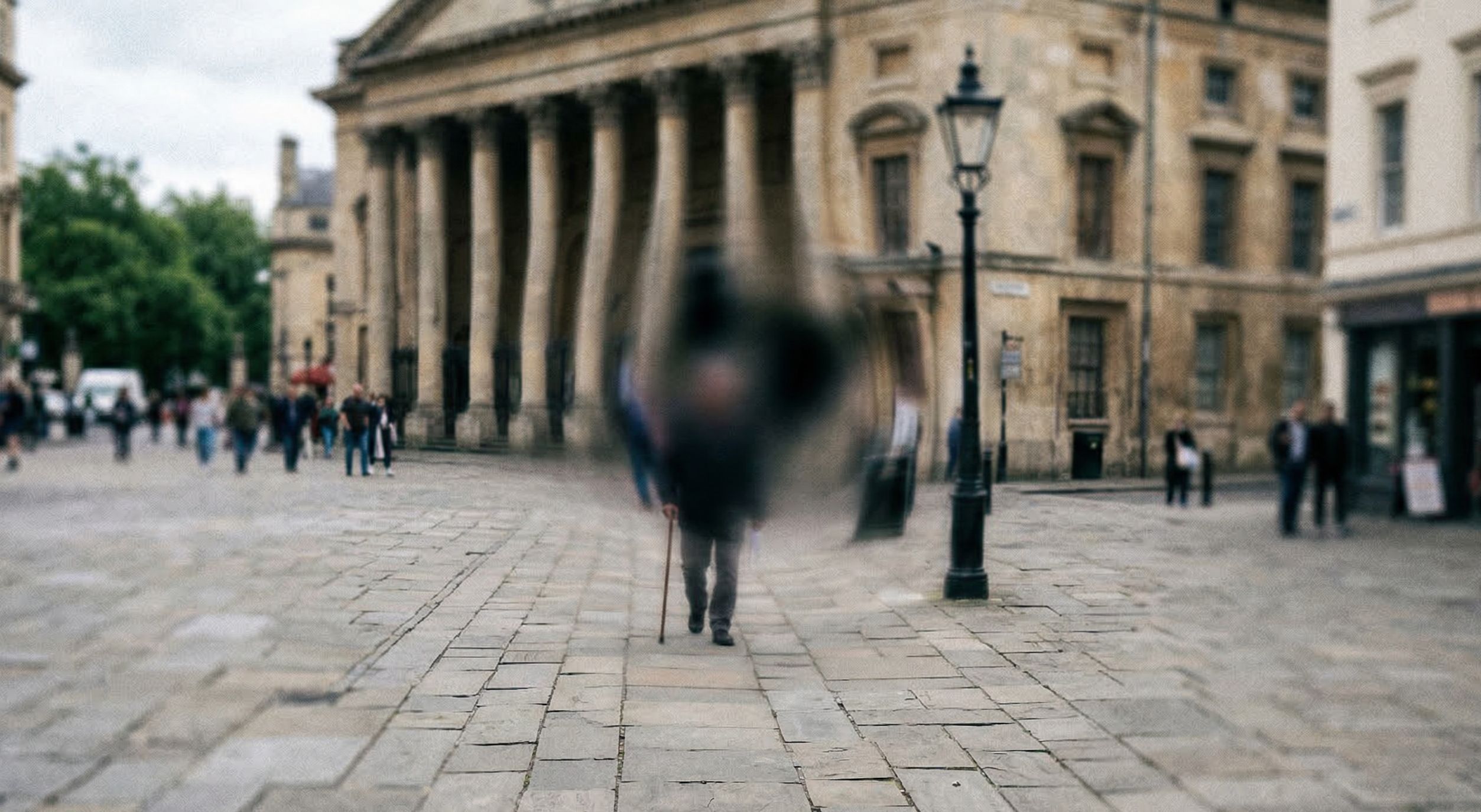 황반변성 환자의 왜곡된 시야