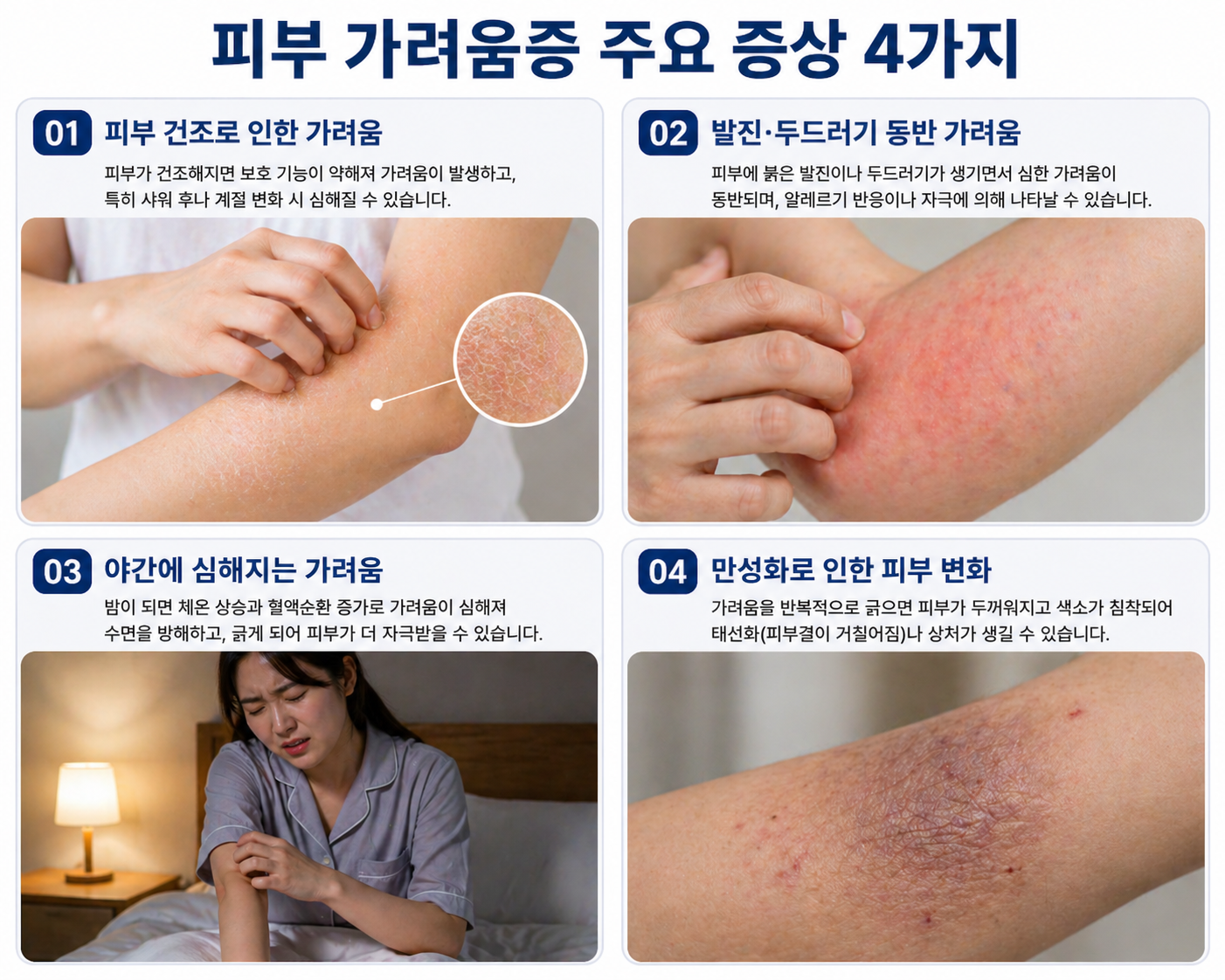 피부 가려움증 증상. 원인. 치료