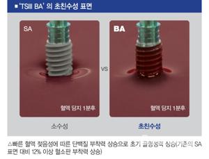오스템임플란트 가격