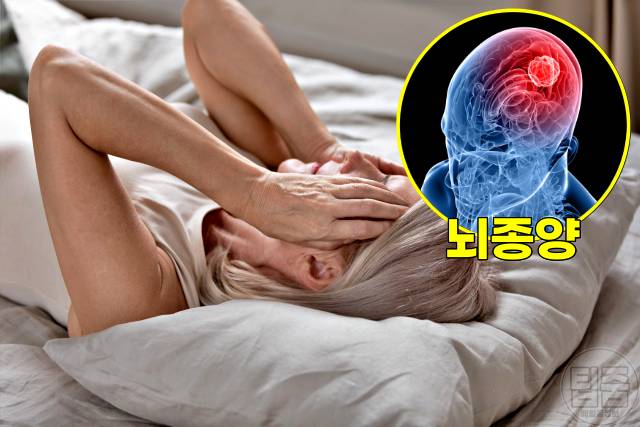 치매 증상 의심 뇌종양 갑상선 비타민 섬마 우울증