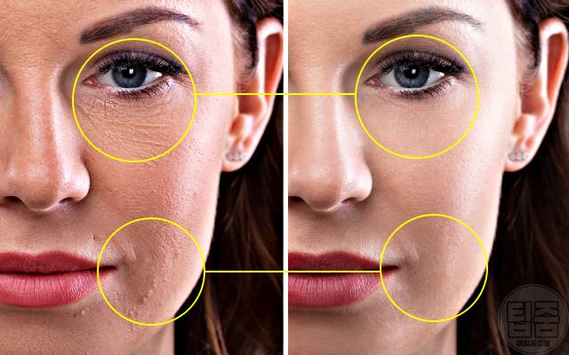 멜라토닌 부족 증상 노화