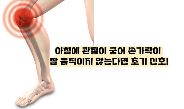 류마티스 관절염 초기증상