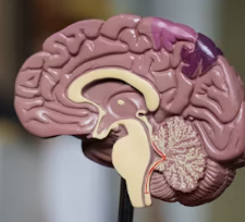 편두통 원인 증상 없애주는 간단한 습관 5가지