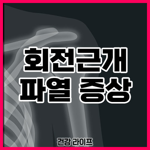 회전근개파열 증상