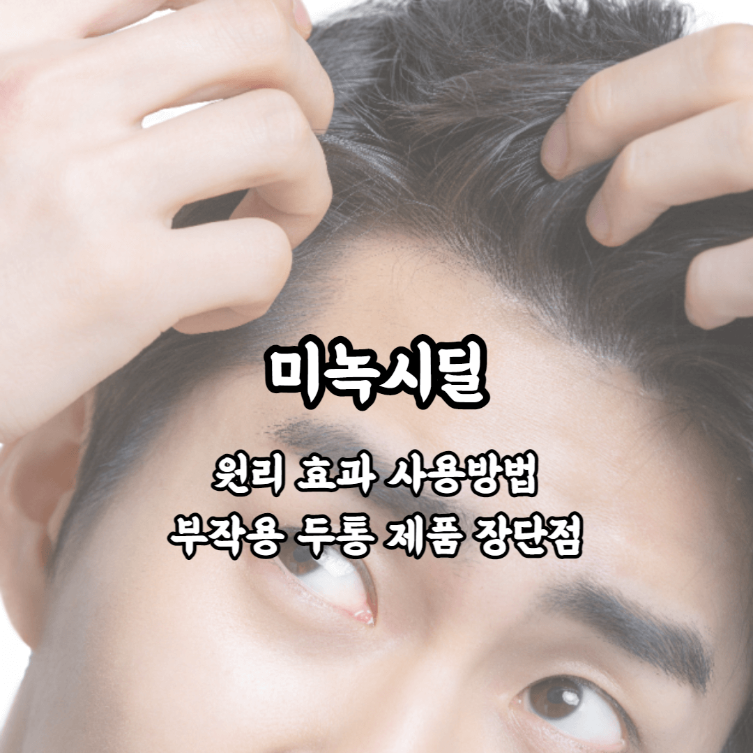 미녹시딜 고혈압약 탈모치료제 원리 효과 사용방법 부작용 두통 제품 장단점
