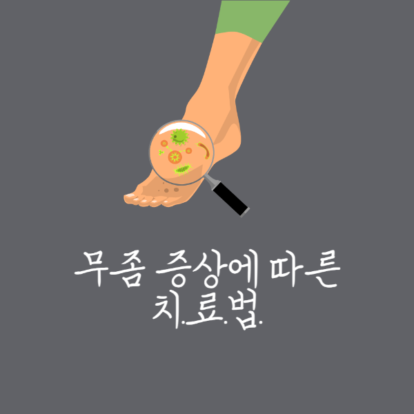 무좀