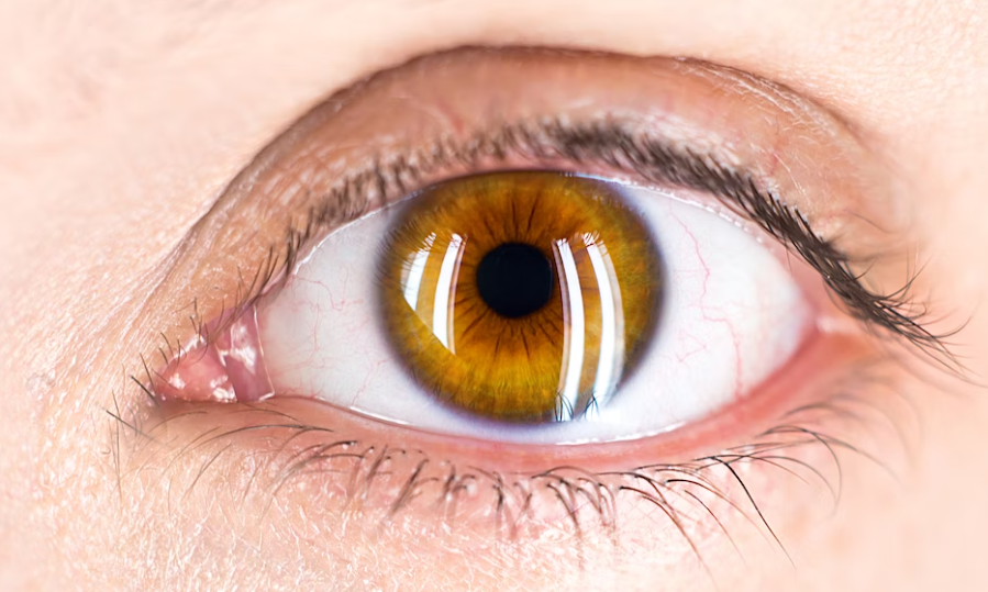 백내장의 발생원인과 증상을 알아보고 예방해요