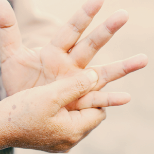 손가락 관절염 치료법