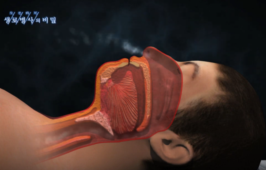 코골기 발생 전