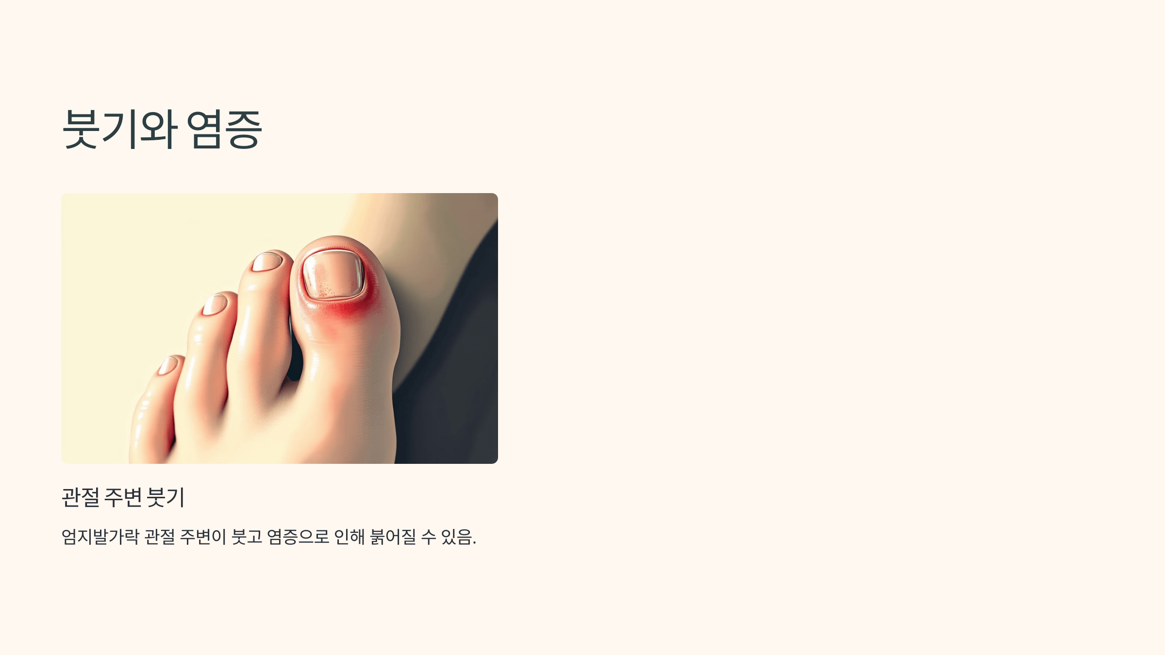 무지외반증과 관련된 사진입니다.