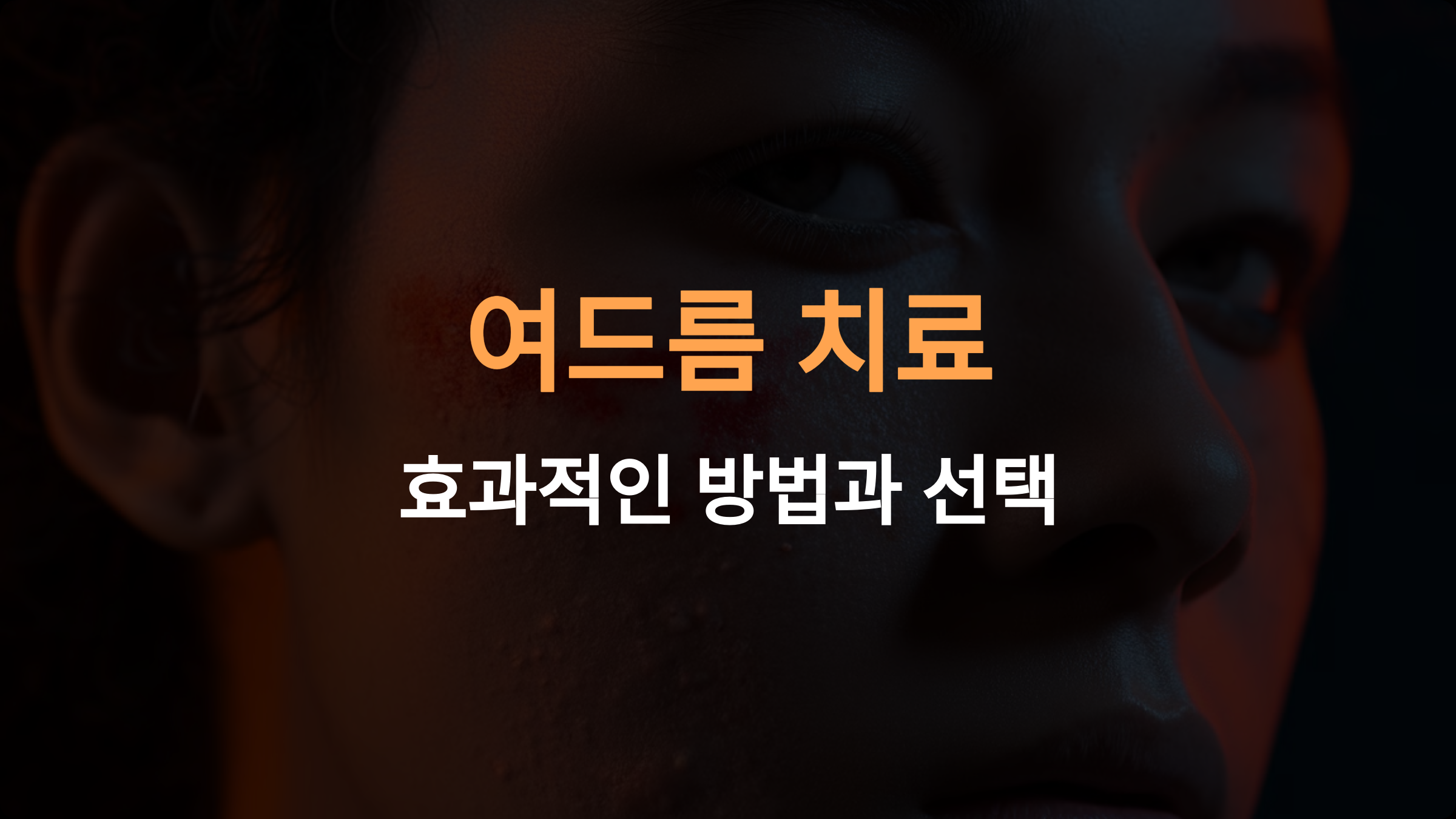 여드름 치료: 효과적인 방법과 선택 가이드