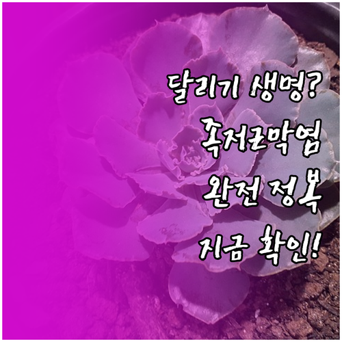 달리기 생명 발 건강 족저근막염 완전..