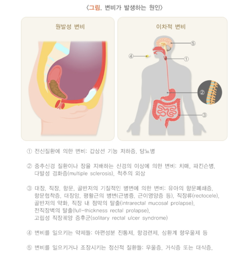 변비의 원인