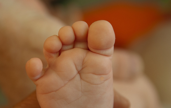 아침에 자고 일어나면 왜 손발이 부어있나요?4