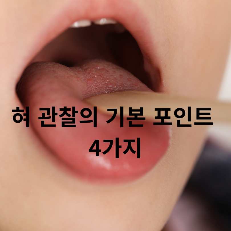 혀 건강 상태 체크법
