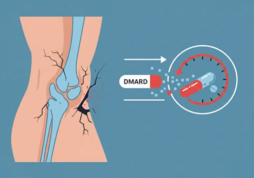 개념적인 일러스트 스타일로 그린&amp;#44; 시간이 지남에 따라 악화되는 관절 손상을 DMARDs 약물이 늦추는 모습