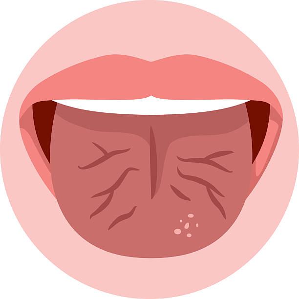 혓바닥 가운데 갈라짐, 단순 증상이 아닐 수 있다