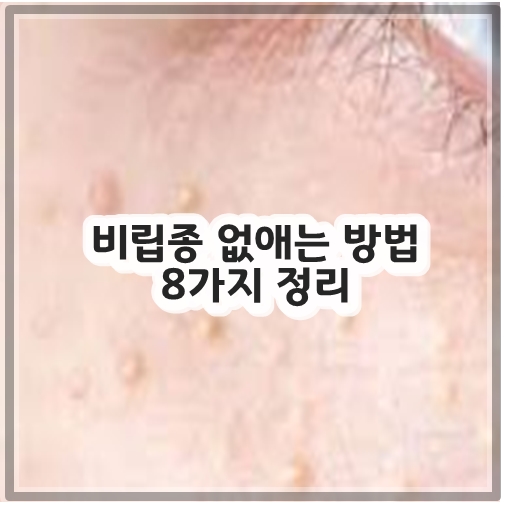 비립종 없애는 방법 8가지 정리