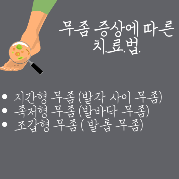 무좀