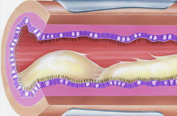 가래에좋은음식추천