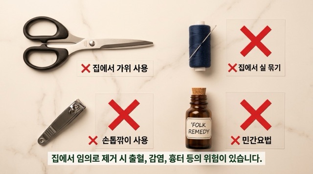 집에서 쥐젖 제거 위험 출혈 감염 흉터 오진 위험 안내 이미지