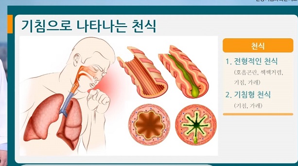 여창동교수-만성기침