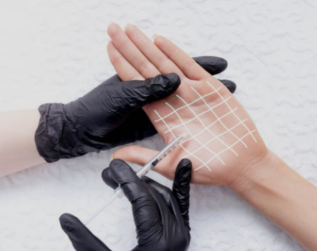 다한증 치료 원인 수술 다한증에 좋은 음식 총정리